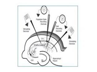 腦片電生理記錄