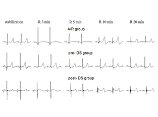 離體心臟缺血模型